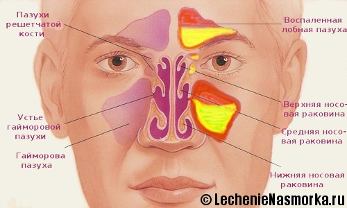 пневматизация пазух носа